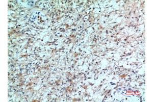 Immunohistochemistry (IHC) analysis of paraffin-embedded Human Brain, antibody was diluted at 1:100. (CXCR2 antibody  (N-Term))