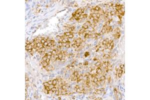 Immunohistochemistry (IHC) image for anti-BRCA1 Associated Protein-1 (Ubiquitin Carboxy-terminal Hydrolase) (BAP1) (AA 460-729) antibody (ABIN6137447)