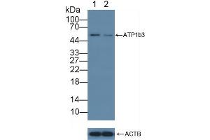 anti-ATPase, Na+/K+ Transporting, beta 3 Polypeptide (ATP1B3) (AA 61-273) antibody