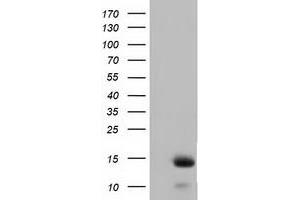 HEK293T cells were transfected with the pCMV6-ENTRY control (Left lane) or pCMV6-ENTRY FSHB (Right lane) cDNA for 48 hrs and lysed. (FSHB antibody)