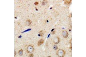 Immunohistochemical analysis of GAB1 staining in human brain formalin fixed paraffin embedded tissue section. (GAB1 antibody  (C-Term))