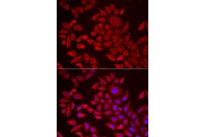 Immunofluorescence analysis of HeLa cells using  antibody (ABIN6129825, ABIN6136640, ABIN6136641 and ABIN6222174). (AGPAT2 antibody  (AA 199-278))