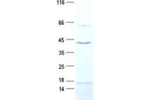 Validation with Western Blot (SLC25A28 Protein (His tag))