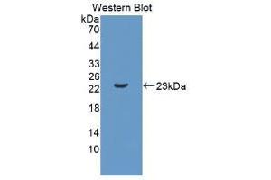 Western blot analysis of recombinant Mouse IL11.