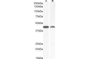 (ABIN2613379) (0. (AMACR antibody  (C-Term))