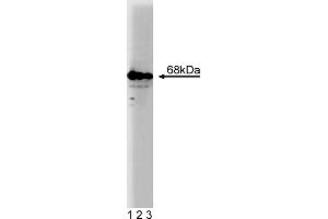 Western Blotting (WB) image for anti-GTPase Activating Protein (SH3 Domain) Binding Protein 1 (G3BP1) (AA 210-323) antibody (ABIN968381) (G3BP1 antibody  (AA 210-323))
