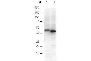 Anti-6X His epitope tag polyclonal antibody detects His-tagged recombinant proteins by western blot.