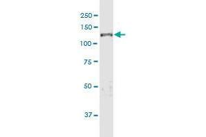 KDM5D antibody  (AA 127-230)