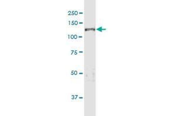 KDM5D antibody  (AA 127-230)