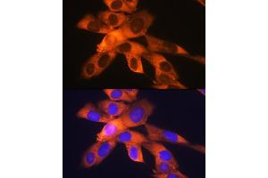 Immunofluorescence analysis of NIH-3T3 cells using RPS19 Rabbit mAb (ABIN1681275, ABIN3017969, ABIN3017970 and ABIN7101552) at dilution of 1:100 (40x lens). (RPS19 antibody)