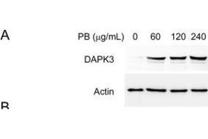 PB triggered cell apoptosis involves elevation of reactive oxygen species (ROS) and accumulation of ER stress. (DAPK3 antibody  (N-Term))