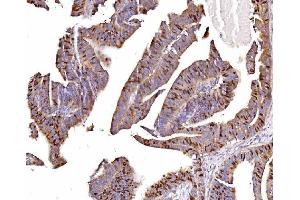 IHC analysis of Geminin/GMNN using anti-Geminin/GMNN antibody (ABIN7600598).