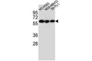 CHRNA10 Antibody (Center) western blot analysis in NCI-H292,MDA-MB453,ZR-75-1 cell line lysates (35µg/lane). (CHRNA10 antibody  (Middle Region))