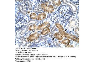Human kidney (P2RX2 antibody  (Middle Region))