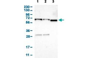 Western Blot analysis of (1) human cell line RT-4 (2) human cell line U-251MG sp, and (3) human plasma (IgG/HSA depleted).