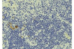 ABIN6277704 at 1/100 staining Human lymph tissue by IHC-P. (PCM1 antibody  (N-Term))