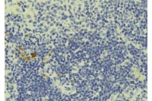 ABIN6277704 at 1/100 staining Human lymph tissue by IHC-P.