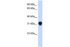 WB Suggested Anti-DNALI1 Antibody Titration: 0. (DNALI1 antibody  (N-Term))