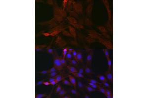 Immunofluorescence (IF) image for anti-Suppressor of Cytokine Signaling 3 (SOCS3) (C-Term) antibody (ABIN3021100)