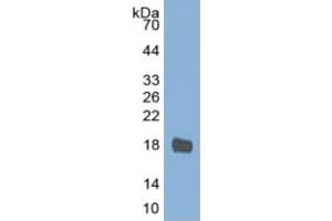 Western Blotting (WB) image for Interleukin 2 (IL2) ELISA Kit (ABIN6574106)