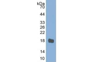 Mouse Capture antibody from the kit in WB with Positive Control: Sample Human Stomach lysate. (IL-2 ELISA Kit)