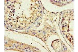 ANGPTL1 antibody  (AA 24-289)