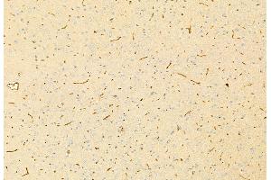 ABIN6265962 and ABIN6269219 at 1/100 staining Mouse brain tissue by IHC-P. (Cadherin 5 antibody  (C-Term))