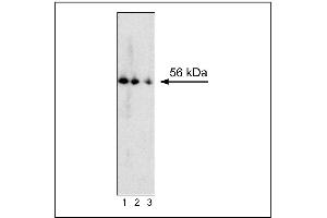 Western blot analysis of RORgammat expression by mouse thymocytes. (ROR gamma T/RORC2/NR1F3 antibody)