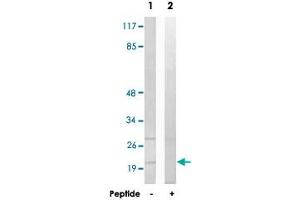 Western blot analysis of extracts from HepG2 cells, using MRPL41 polyclonal antibody .