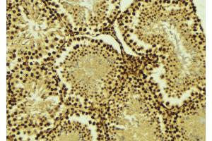 ABIN6274520 at 1/100 staining Mouse testis tissue by IHC-P. (AKIP1 antibody  (Internal Region))