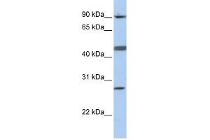 CENPI antibody used at 1 ug/ml to detect target protein. (CENPI antibody  (N-Term))