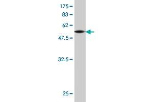 Western Blot detection against Immunogen (55. (Connexin 31 antibody  (AA 1-270))