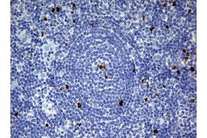 Image no. 7 for anti-Antigen Identified By Monoclonal Antibody Ki-67 (MKI67) (AA 1160-1493) antibody (ABIN1490857) (Ki-67 antibody  (AA 1160-1493))