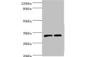 Western blot All lanes: SLC25A15 antibody at 6 μg/mL Lane 1: Mouse liver tissue Lane 2: Mouse stomach tissue Secondary Goat polyclonal to rabbit IgG at 1/10000 dilution Predicted band size: 33 kDa Observed band size: 33 kDa (SLC25A15 antibody  (AA 1-301))