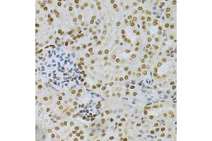 Immunohistochemistry of paraffin-embedded mouse kidney using DKC1 Antibody (ABIN5970956) at dilution of 1/200 (40x lens). (DKC1 antibody)
