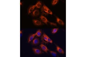 Immunofluorescence analysis of C6 cells using R antibody (ABIN7269856) at dilution of 1:100.