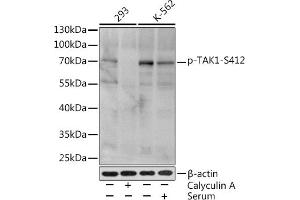 Western blot analysis of extracts of various cell lines, using Phospho-T-S412 Rabbit pAb (ABIN3019511, ABIN3019512, ABIN3019513 and ABIN6225441) at 1:1000 dilution. (MAP3K7 antibody  (pSer412))