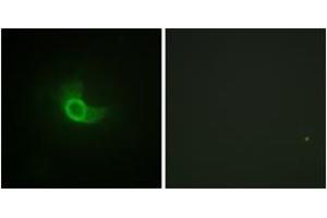 Immunofluorescence analysis of NIH-3T3 cells, using CD130/gp130 (Ab-782) Antibody. (CD130/gp130 antibody  (AA 748-797))