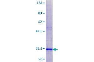 SPINK7/ECRG2 Protein (AA 1-85) (GST tag)