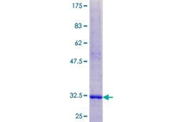 SPINK7/ECRG2 Protein (AA 1-85) (GST tag)