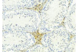 ABIN6274858 at 1/100 staining Mouse testis tissue by IHC-P. (Apolipoprotein L 4 antibody)