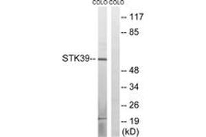 Western blot analysis of extracts from COLO cells, using STK39 (Ab-311) Antibody.