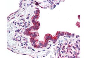 Anti-MICU1 / CBARA1 antibody IHC staining of human lung, respiratory epithelium.