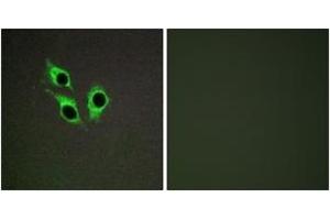 Immunofluorescence analysis of HepG2 cells, using TM16J Antibody. (ANO9 antibody  (AA 481-530))