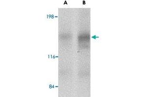 Western blot analysis of CADPS2 in human brain tissue lysate with CADPS2 polyclonal antibody  at (A) 0.