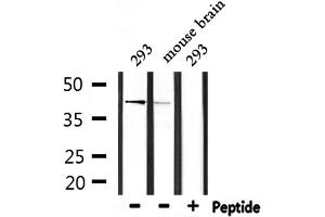 Western blot analysis of extracts from 293 and mouse brain, using ARRDC3 Antibody. (ARRDC3 antibody  (C-Term))