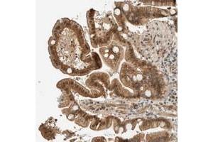 Immunohistochemical staining of human duodenum with FAM129B polyclonal antibody  shows moderate cytoplasmic, nuclear and membranous positivity in glandular cells.
