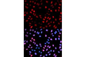 Immunofluorescence analysis of U2OS cells using Phospho-RAF1-S621 antibody. (RAF1 antibody  (pSer621))
