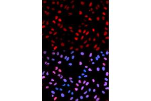 Immunofluorescence analysis of U2OS cells using Phospho-RAF1-S621 antibody. (RAF1 antibody  (pSer621))