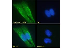 ABIN185104 Immunofluorescence analysis of paraformaldehyde fixed HeLa cells, permeabilized with 0.